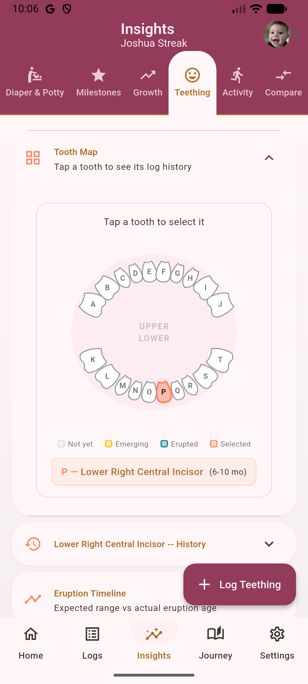Teething tooth map tracker